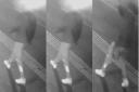 Detectives released images capturing the suspect in the Queens Park shooting last month