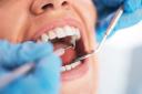 Are you looking after your teeth properly? Here’s how to keep them healthy and strong