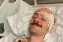 Jack Chambers in hospital after brain tumour surgery
