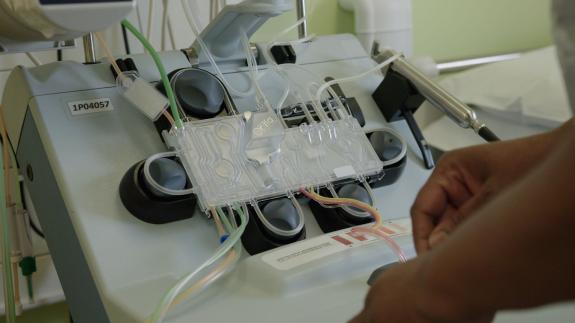 Brent & Kilburn Times: Automated Red Blood Cell Exchange Machine Brent & Kilburn Times: Automated Red Blood Cell Exchange Machine
