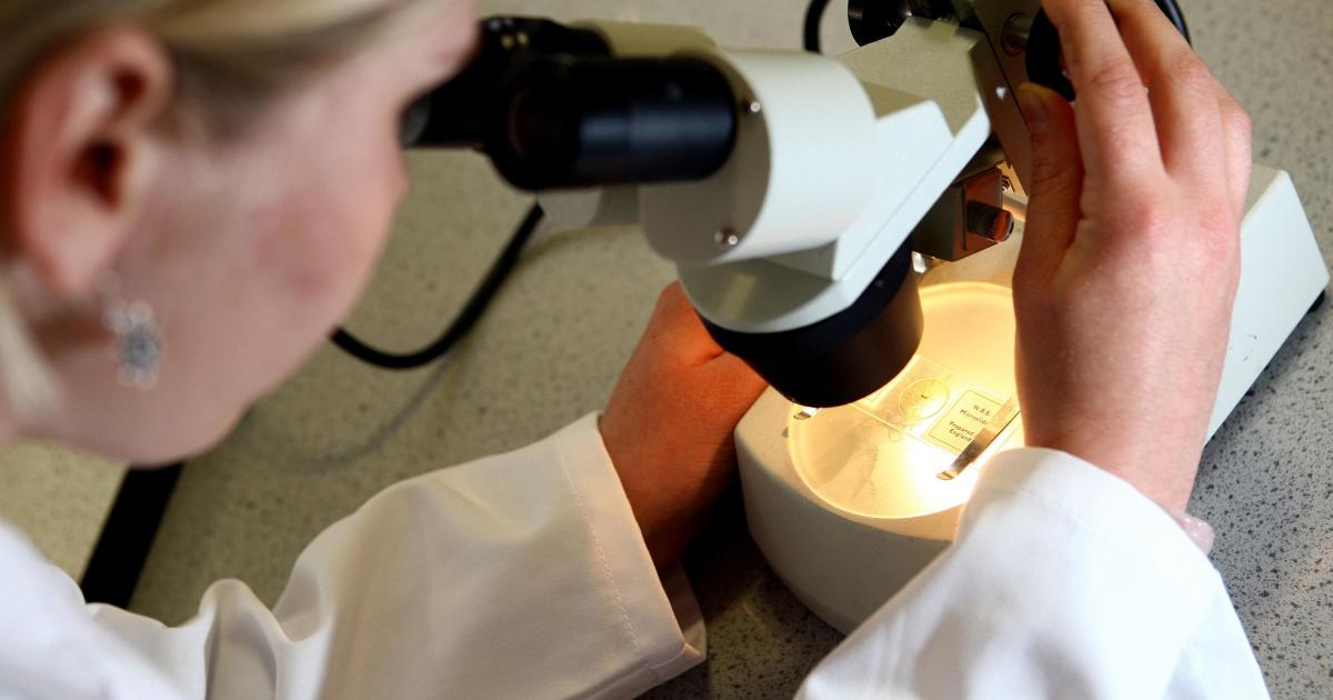 Researchers identify cases of Alzheimer's believed to be passed on from donors - Vimarsana News